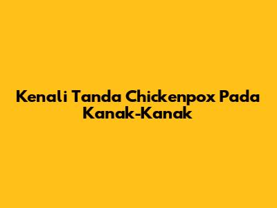 Kenali Tanda Chickenpox Pada Kanak-Kanak