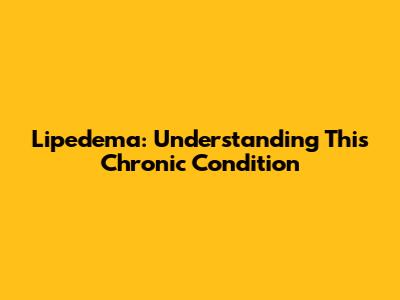 Lipedema: Understanding This Chronic Condition
