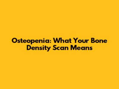 Osteopenia: What Your Bone Density Scan Means