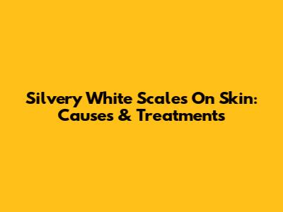 Silvery White Scales On Skin: Causes & Treatments