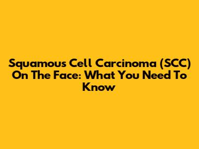 Squamous Cell Carcinoma (SCC) On The Face: What You Need To Know